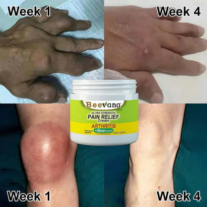 Bee-Venom Gold Pain-Relief Bone Healing Cream